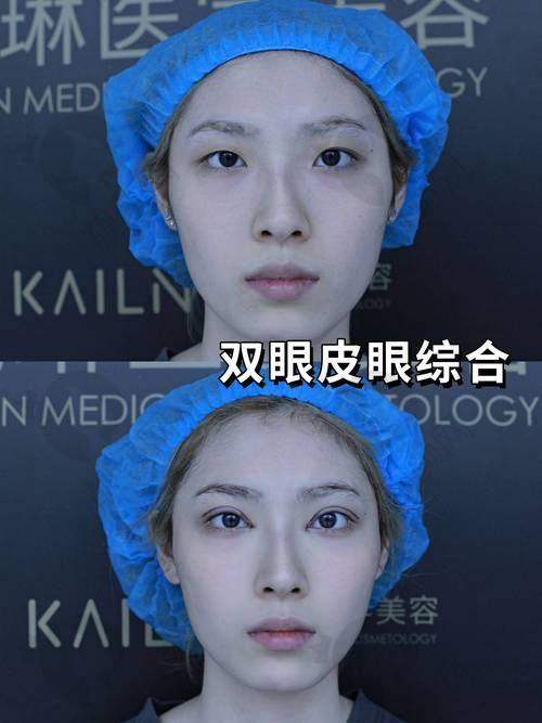 李在郁医生在哪家医院出诊？答案是北京漾格医美
