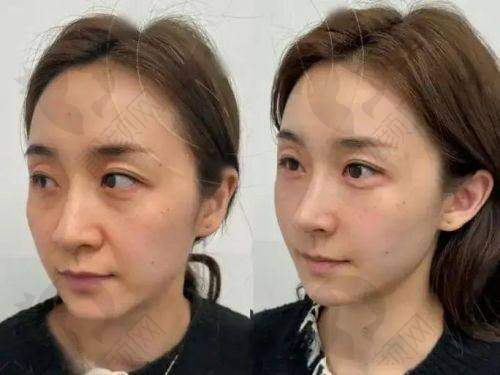 北京漾格医美的预约方式