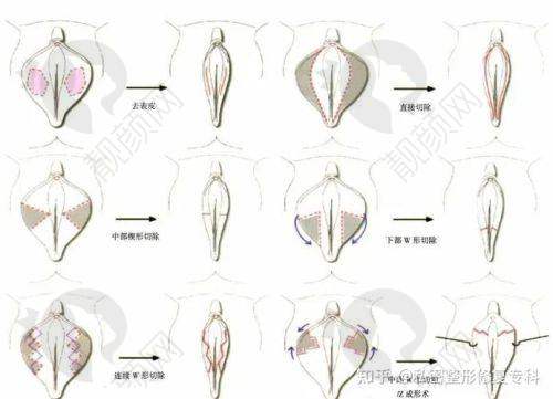北京私密整形去哪家医院好？北京嘉禾妇儿医院实力雄厚