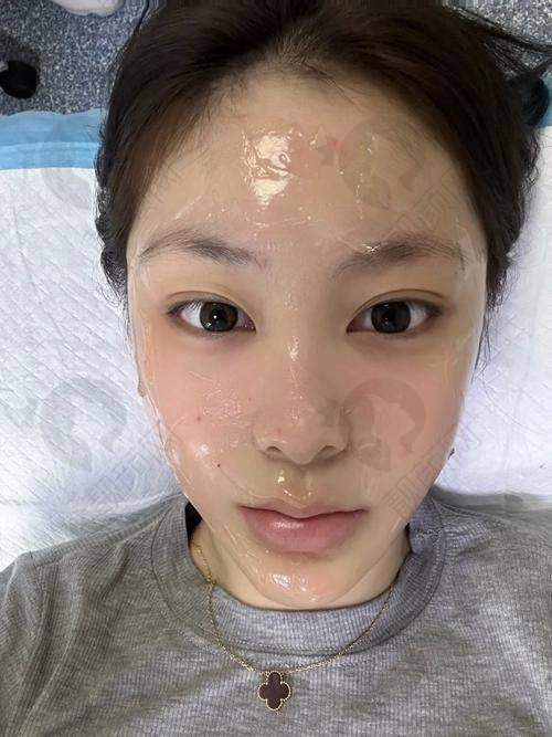 深圳安美聚光整形光子嫩肤价格详情解析