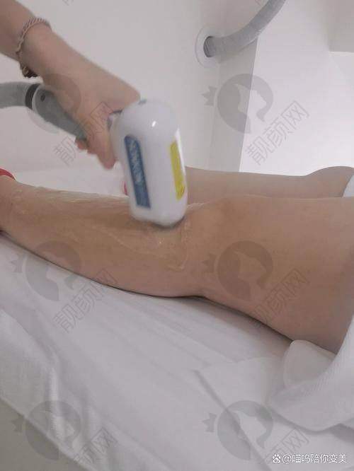 兰州皙妍丽整形：专属定制的冰点脱毛体验