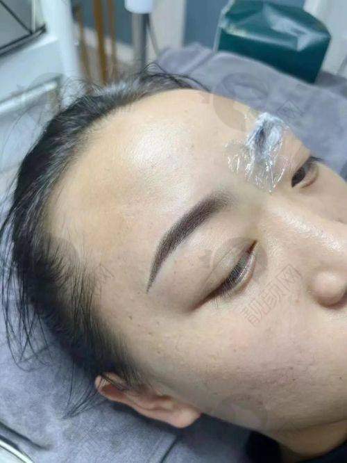 南宁华美整形的纹眉技术实力特点