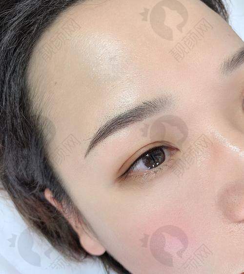 南宁华美整形的纹眉价格与优惠
