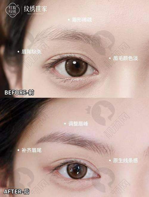 南宁华美整形的服务与口碑评价