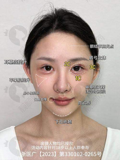 北京艺星魅力微整价格详情解析