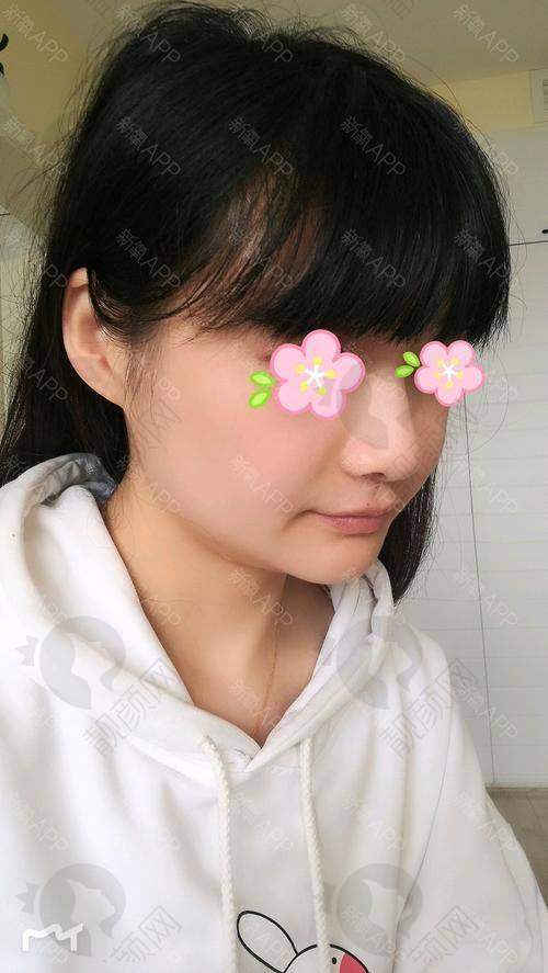 把控填充次数让成效更持久