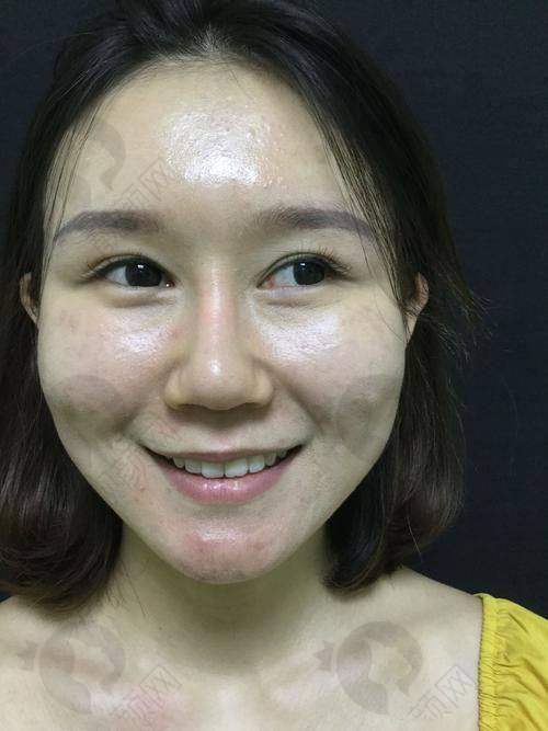 六、深圳名丽医疗美容医院实例：
