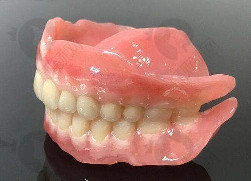 广州穗华口腔医院是否正规靠谱？——种植牙技术优势显著