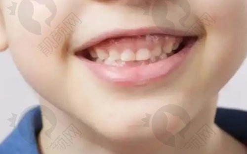 一、芜湖壹加壹口腔怎么样？