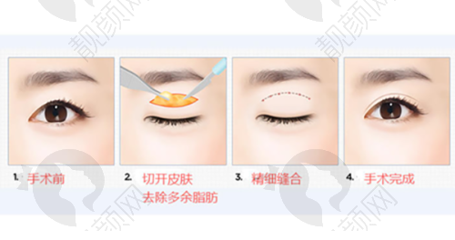 七、东莞壹加壹整形医院怎么预约：