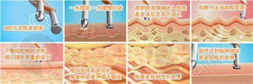 联合丽格鼻整形特色技术揭秘