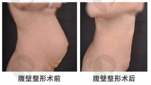二、东莞壹加壹整形医院正规吗？来看看医院资质：