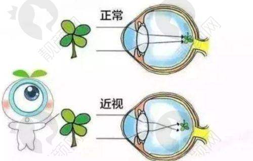 爱尔眼科强大的医生团队
