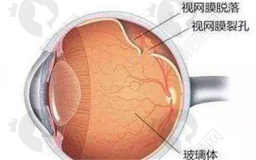 郑州爱尔眼科医院电话是多少?高口碑技术信息探秘