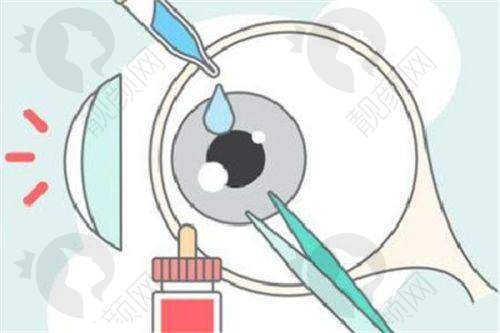 2025郑州视光眼科医院的技术优势