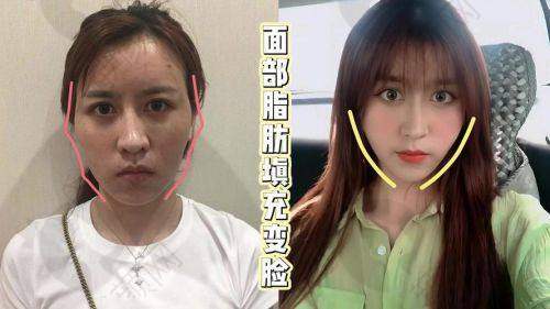 广西亚太医疗美容医院黎冻主事介绍