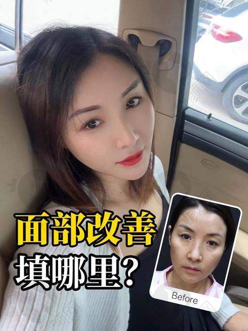 广西亚太医疗美容医院的优点总结