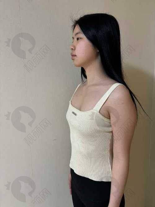 脂肪填充胸部价格揭秘：与其他隆胸方式的价格对比
