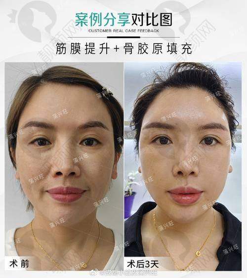 北京蒂凡妮王志坚医生做什么项目技术好？三点无痕术+TCM技术，口碑佳值得信赖！