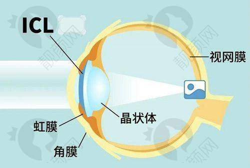七、成都华厦眼科医院怎么预约：