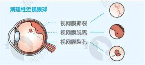 三、中山华厦眼科医院医生介绍: