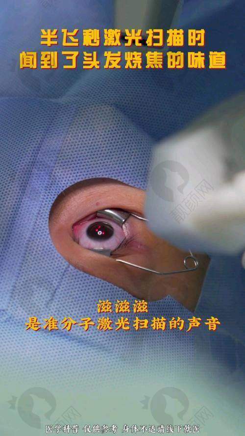 牡丹江爱尔眼科医院半飞秒精细化雕刻C+手术的医生团队