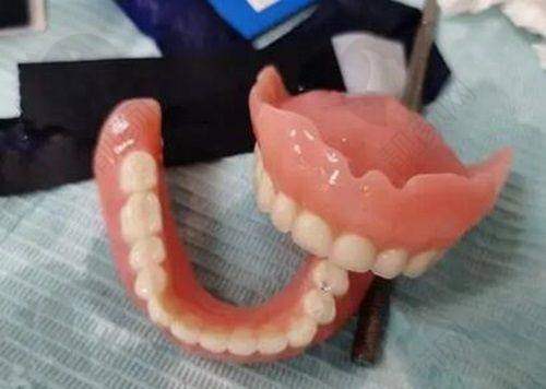 矫正项目情况