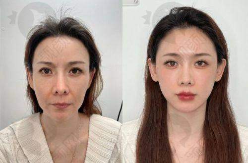 全周期管理：开启美丽新篇