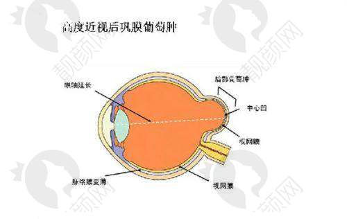 新疆四七四 医院眼科便捷的就诊地址