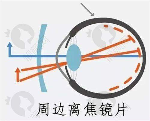 一、合肥名人眼科医院怎么样？