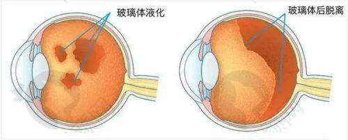 一、厦门眼科中 心龙岩眼科医院怎么样？