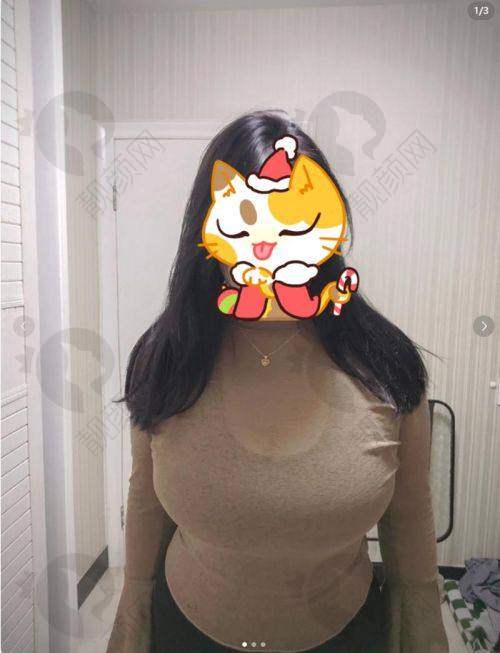 重庆缩胸三等甲整形医院综合推荐