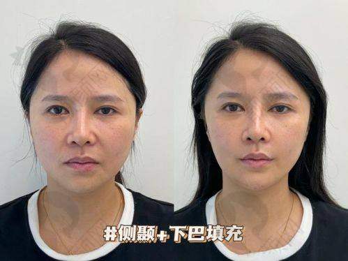 郑州脂肪填充有名整形医生排名大揭秘，医生所在医院优势凸显