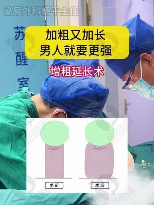 不同价格的玻尿酸，增粗成效有啥不同？