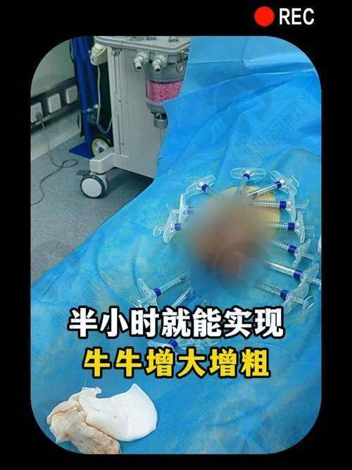 选择玻尿酸男性增大注射，该注意啥？