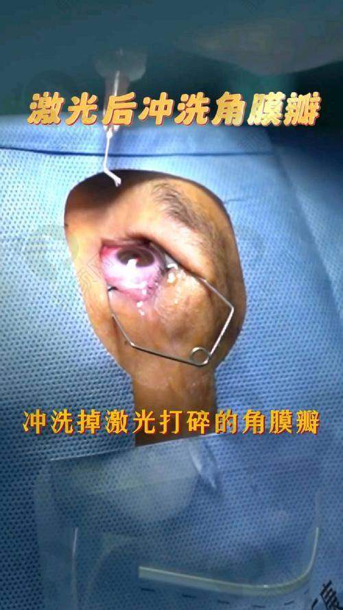 无锡华厦眼科医院患者口碑:良好值得信赖