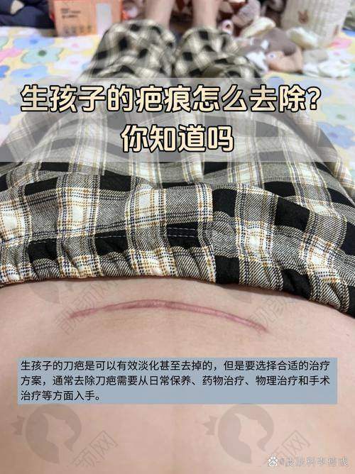 北京京城皮肤医院祛疤好吗？林开金医生价格1000元起性价比分析