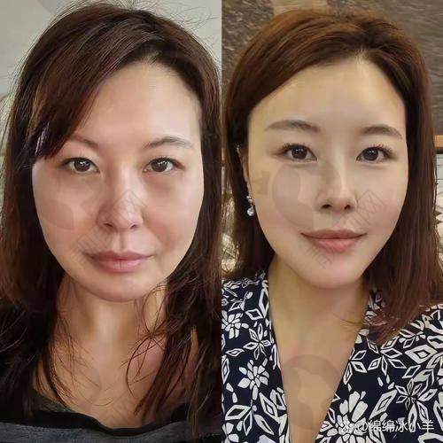 术后护理：让成效更持久