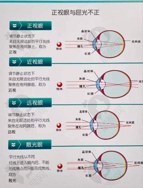 北京后巩膜加固术医生排名推荐：段安丽医生，微创治疗显优势