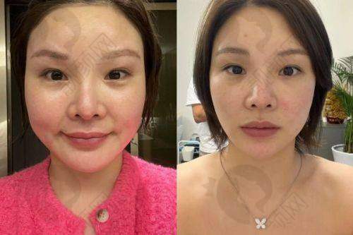 太原正规的整形医院之太原华美医疗美容医院
