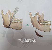 八、承德欧亚圣美医疗美容门诊部的口碑评价怎么样