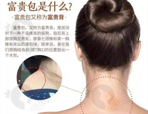 八、潍坊华央创和（原华美）医疗美容医院的口碑评价怎么样