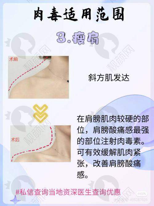 七、梅州半岛医疗美容诊所怎么预约：