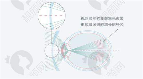 九江爱尔眼科医院口碑评价好