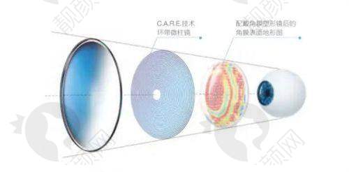 肇庆爱尔眼科医院预约挂号注意事项要牢记