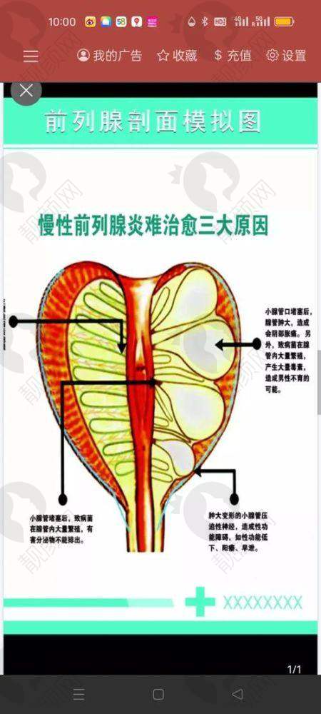 男性延时针的成效与价格的性价比