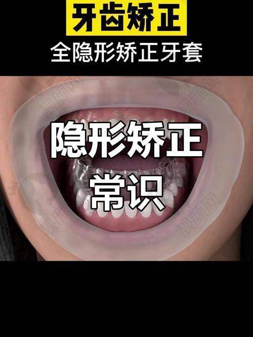 美立刻隐形矫正属中高端档次？多型号选择满足多样需求