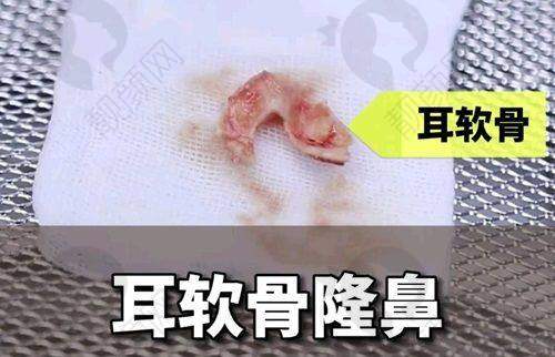 七、苏州柏达丽医疗美容门诊部怎么预约：