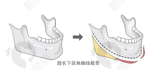 一、苏州柏达丽医疗美容门诊部怎么样？