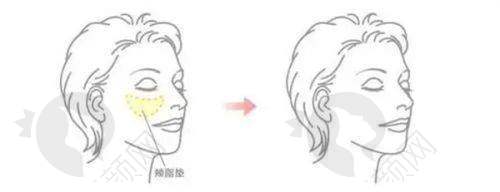 西安张永医生其他擅长项目:实力全方面